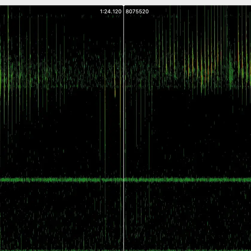 Sonogram variationer